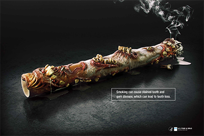 Smoking Can Cause Stained Teeth poster